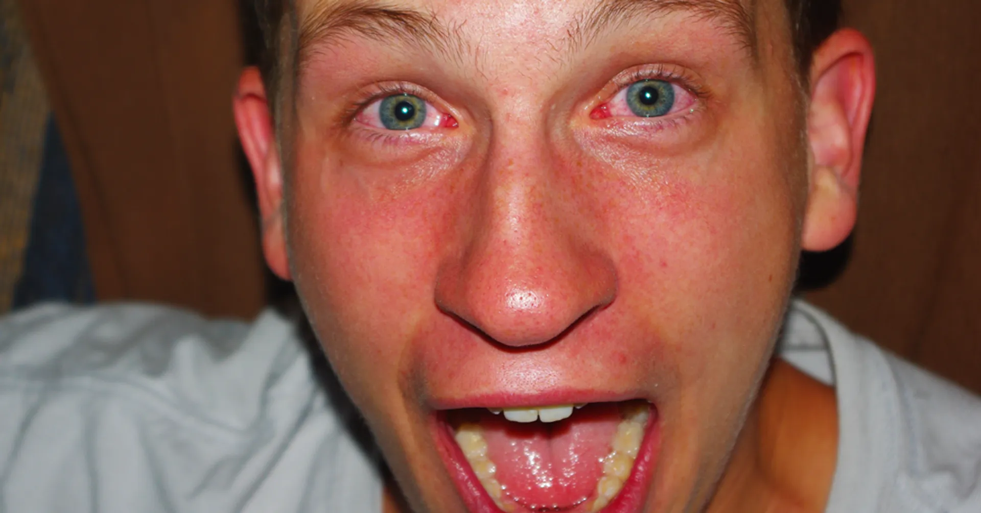 Afbeelding van 10 x Jullie kutste bad trip verhalen