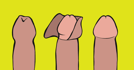 Afbeelding van Besnijden